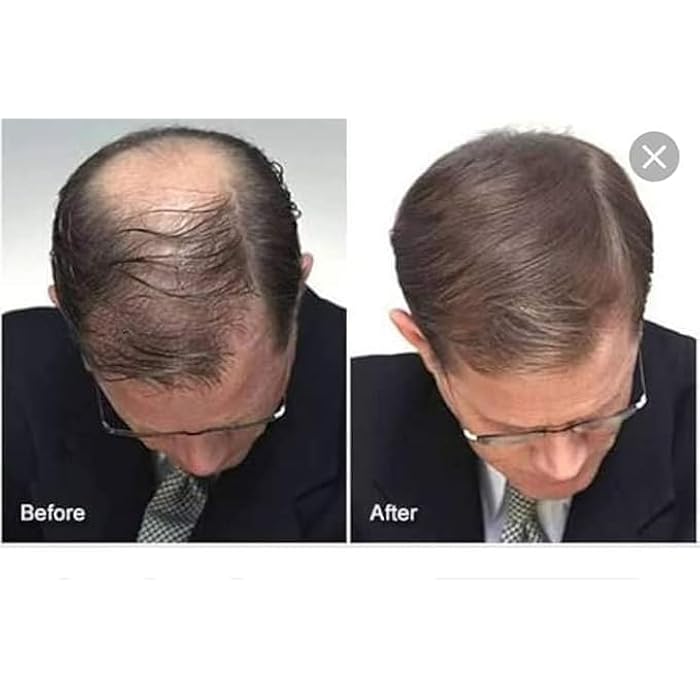 FASTER HAIR BACK CAFFEINE EXTRACT 100ML - Image 3